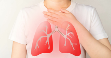 Chronic Cough Trial